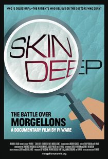 Skin Deep: The Battle Over Morgellons